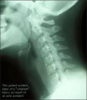 CAROLINA GENDELMAN COLL oficios y profesiones en Vitacura |  Quiropr&aacute;ctica titulada en extranjero. especialista en extremidades., Columna vertebral, hernias de disco, artrosis, dolores de cabeza.